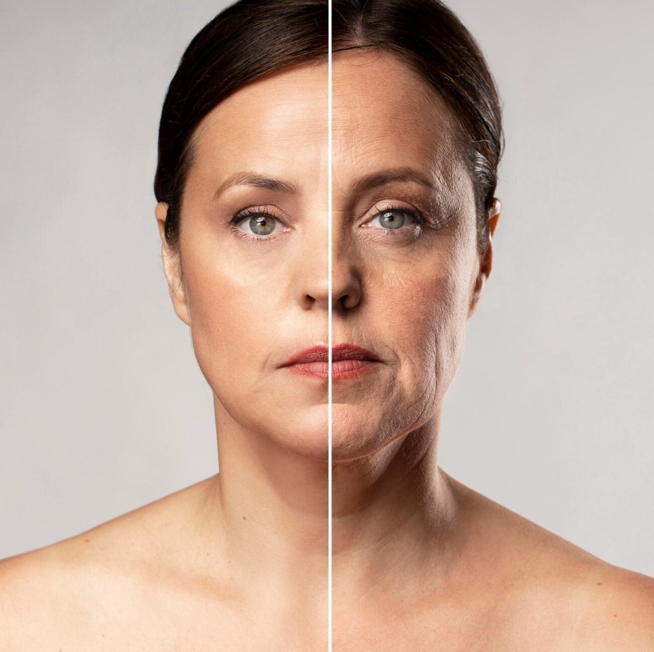 Harmonização facial
