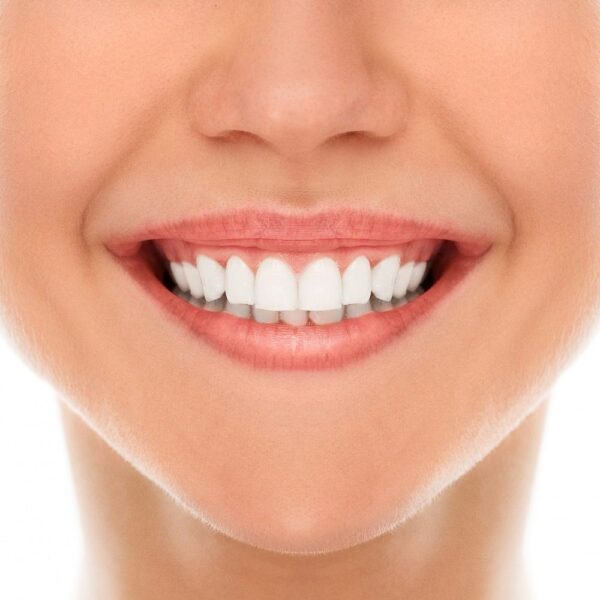 invisalign
